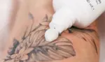 avene-cicalfate-post-acte-post-tattoo-%ce%b5%cf%80%ce%b1%ce%bd%ce%bf%cf%81%ce%b8%cf%89%cf%84%ce%b9%ce%ba%ce%ae-emulsion-40ml-mamaspharmacy-2